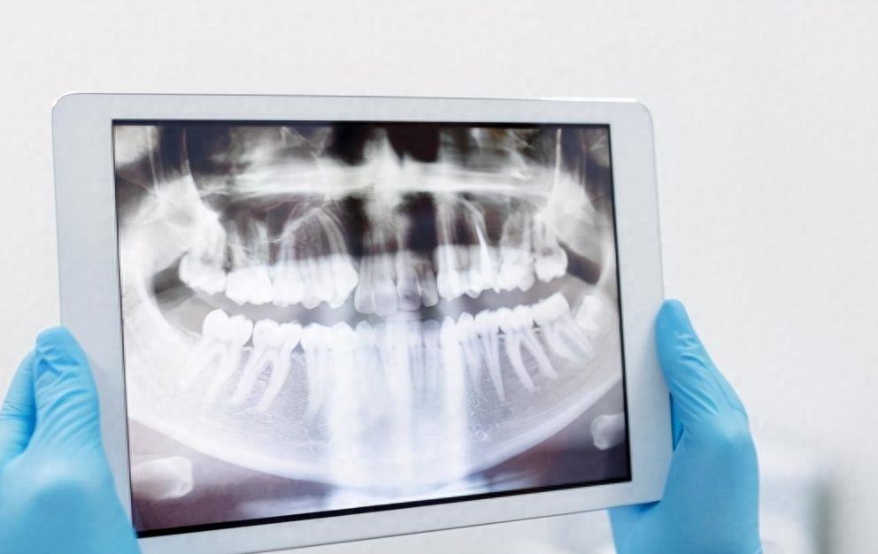 武汉皓诺口腔:牙齿矫正价格全解析及服务优势一览(图1)