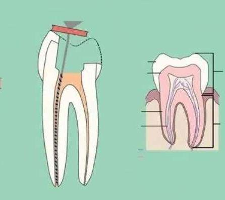 工伤牙齿修复费用解析:全额报销可能性及责任承担者(图2)