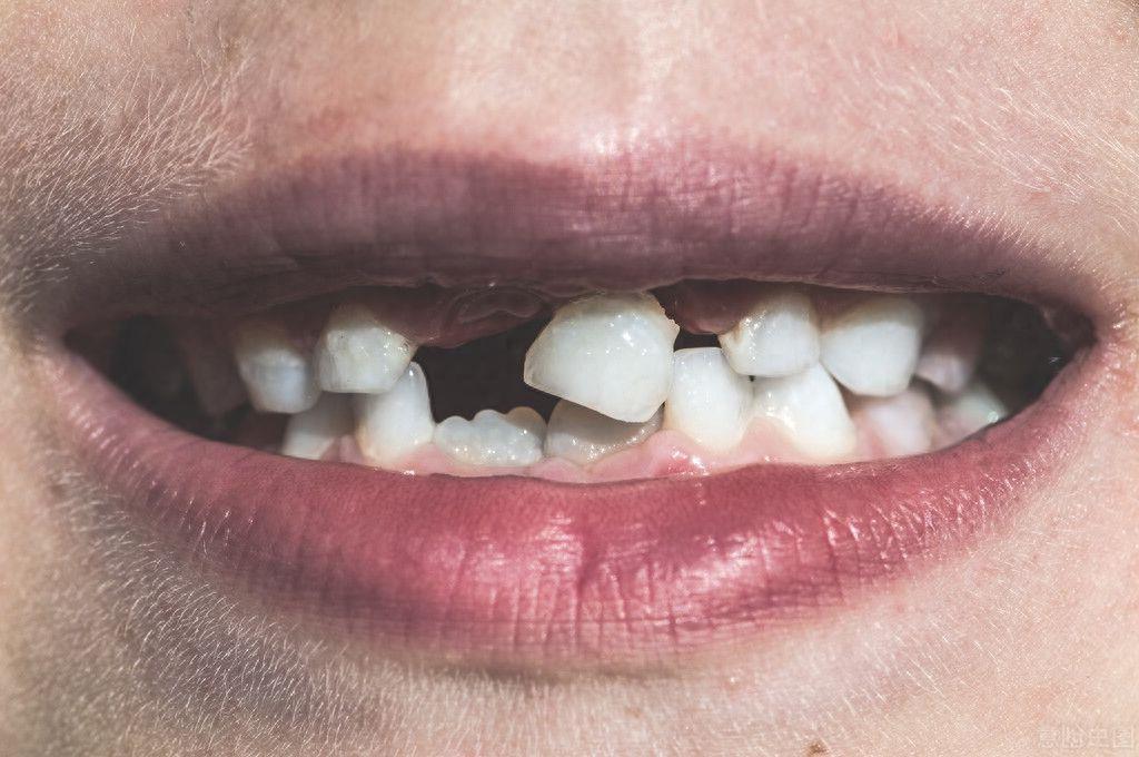 百丈区牙科诊所推荐：杭牙未来与泽一口腔的比较分析(图2)