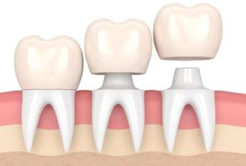 玉溪西瑞口腔诊所服务项目及价格全解析(图1)