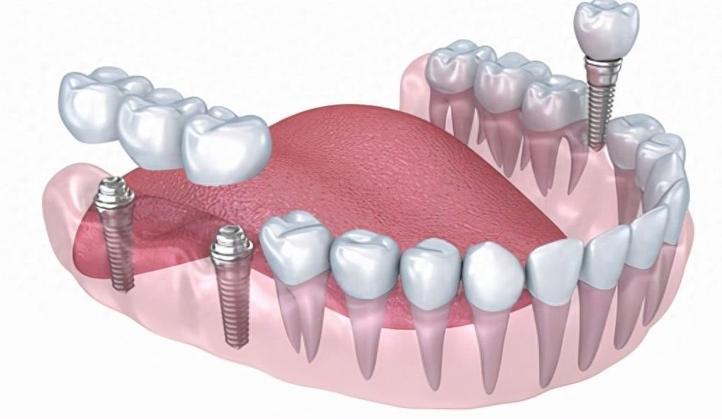 新桥口腔医院全新收费标准揭晓:价格亲民,服务优质(图1)