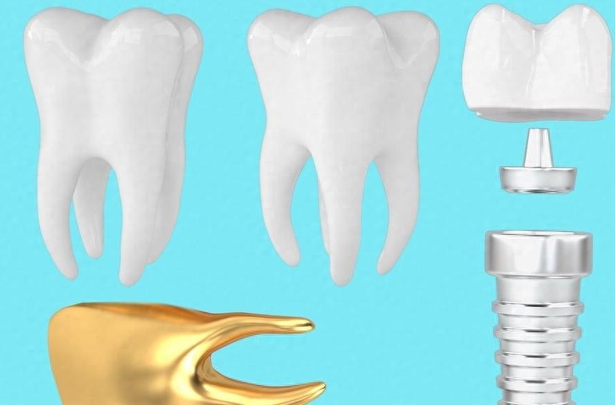 牙齿矫正新趋势:价格与技术革新并行(图1)
