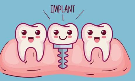 2024广州种植牙排名前十医院推荐,哪家口腔医院好?(图2)