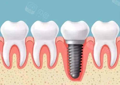 2024年口腔整形医院排名:排行榜前五发布烟台孙腔、浙江医院等供参考(图1)