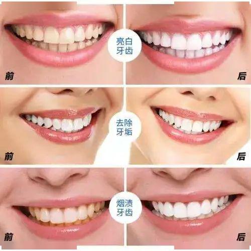 重庆荣昌区口腔医院哪家好?这5家荣昌口碑牙科机构技术过硬,收费透明!(图3)