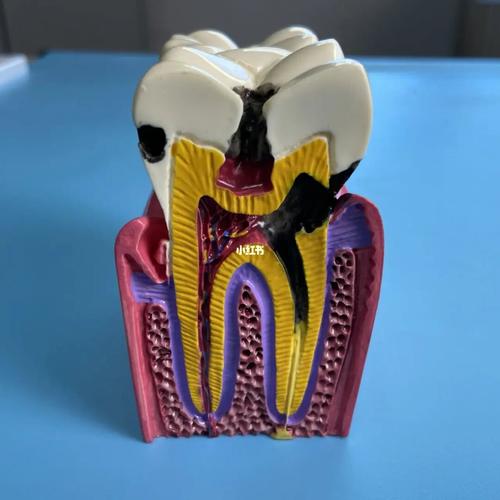 牙齿矫正需要多少钱?牙齿矫正的最佳年龄是多少岁?(图2)