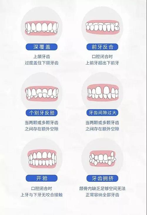 遵义英杰口腔医院收费价格表：补牙150元起、牙齿矫正6800元起、种植牙2580元起、牙冠650元起！