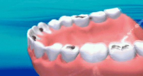 牙齿矫正必看！绵阳哪家口腔医院好？巫露霞口腔-恒齿口腔-唐友生口腔-皓铭口腔-何松林口腔等专业矫正~(图2)