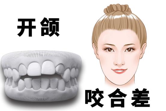 临沂牙齿矫正医院哪家好?权威推荐:临沂刘子斌口腔、临沂银座牙客口腔、临沂晓波口腔等5家优质机构(图2)