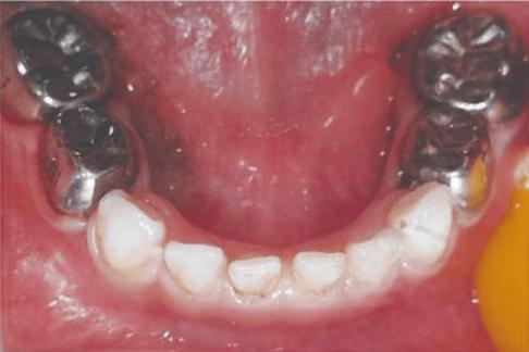 襄阳号尔口腔数字化种植矫正中心专业解析,南街机构矫正种植双保障获市民青睐!(图1)