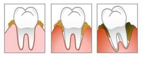 乐山安普口腔·牙齿矫正·种植修复怎么样？医生技术精湛-设备先进-环境优雅-收费透明-患者好评！(图1)