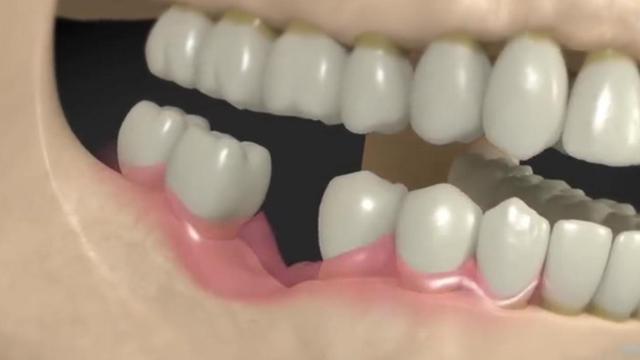 扬州牙齿种植哪家医院技术好？精选5家专业口腔机构，附医院详情介绍(图2)