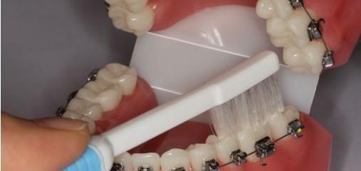 上海牙齿矫正医院排名公布,排名前五的医院是上海松峰口腔、上海TSK齿科德信会口腔门诊(图2)