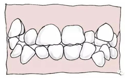 鞍山奥新全民口腔价格表：洗牙38+-拔智齿88+-补牙268+-牙周改善128+-冷光美白499+(图2)