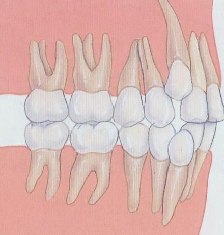 驻马店植得口腔医院收费贵吗？解析牙齿矫正种植费用及特色项目优势(图4)