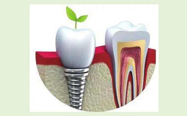 株洲唯美口腔牙齿矫正需要多少钱?最新牙套价格表公布(图3)