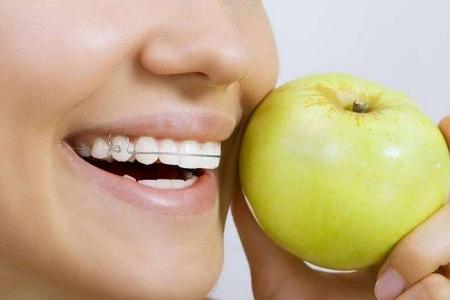 牙齿矫正全周期指南：太原尤根口腔专家详解1-12个月变化与科学护理方法(图2)