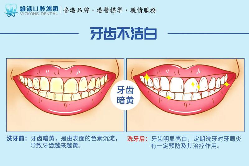 包头种植牙多少钱一颗2025价格表？种植牙7284-20126元+全瓷牙6700-20372元+隐形矫正11274-27