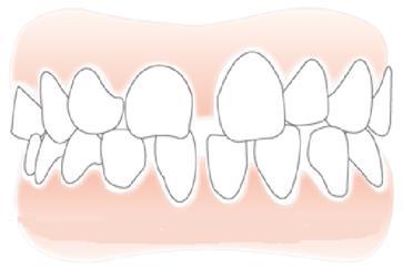 上海浦东新区哪家口腔医院好？推荐5家正规靠谱的牙齿矫正-种植牙机构
