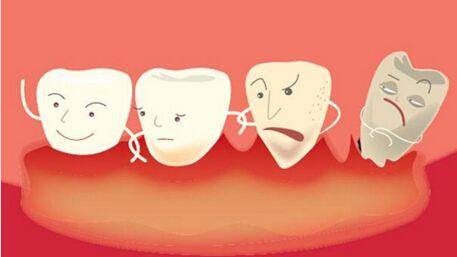 濮阳雅美口腔牙齿种植价格表:普通种植6000+全口种植40000+(图2)