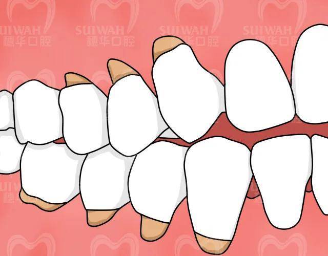 荆州牙科医院哪家技术好？种植牙、牙齿矫正这几家实力机构值得推荐！(图2)