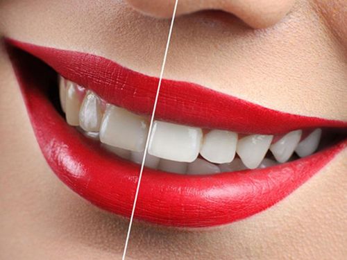 长沙优伢仕口腔·牙齿种植矫正中心看牙专业吗？附详细地址+医生团队介绍+患者真实反馈！(图1)