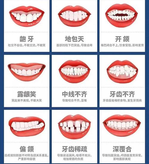 临沂牙齿矫正医院哪家好?权威推荐:临沂刘子斌口腔、临沂银座牙客口腔、临沂晓波口腔等5家优质机构(图1)