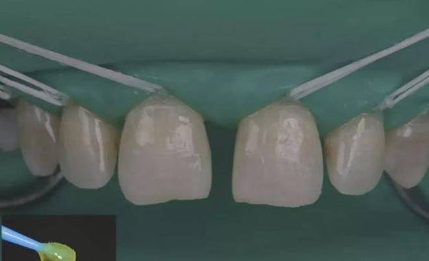 牙齿矫正无忧!南昌专业口腔医院全解析,2025最新牙齿矫正医院推荐指南(图3)