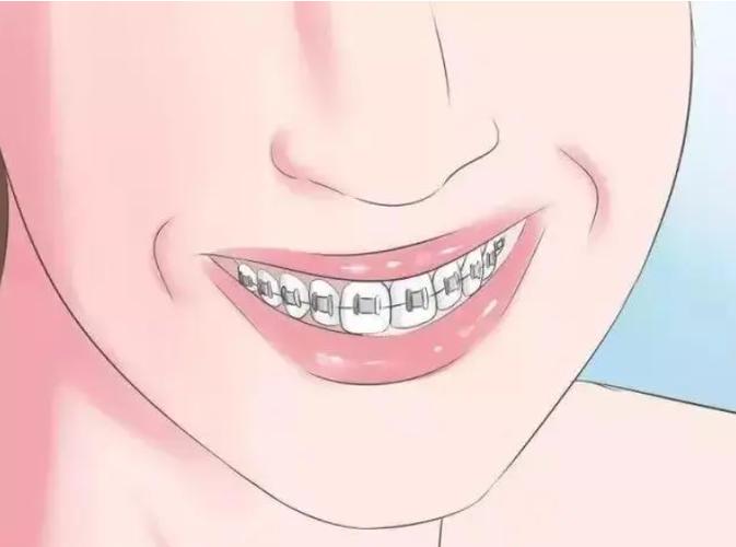 株洲牙齿矫正哪家医院好？荷塘-天元-芦淞区这5家专业口腔机构值得选！