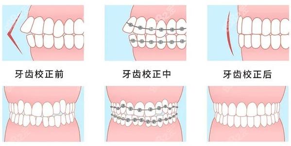 宜昌和谐口腔收费贵吗？价格透明无隐形消费丨技术专业获好评丨本地人信赖之选！(图2)