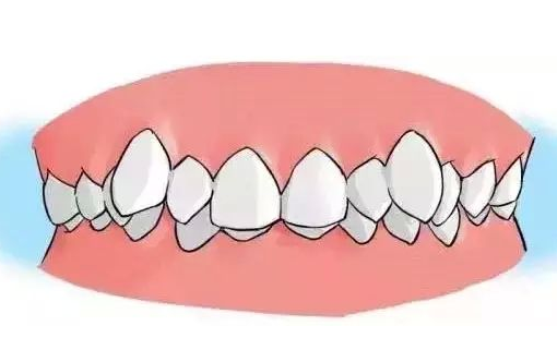 上海牙齿矫正医院排名公布,排名前五的医院是上海松峰口腔、上海TSK齿科德信会口腔门诊(图1)