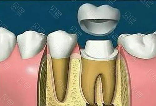 盘锦牙博士口腔种植牙矫正技术怎么样？真实顾客评价技术专业服务细致看牙体验分享！(图2)