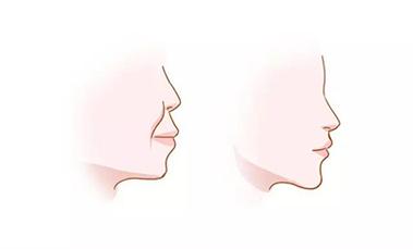 杭州齿诺口腔数字化正畸种植中心到院地址详解，专业医师团队配备先进设备提供个性化治疗方案！(图1)