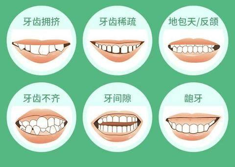 盘点东莞热门牙科机构，这三家口腔正畸技术领先需提前预约(图3)