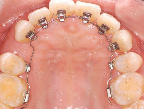 株洲天元区正规口腔排行前五！专业种植矫正技术强收费透明！(图1)