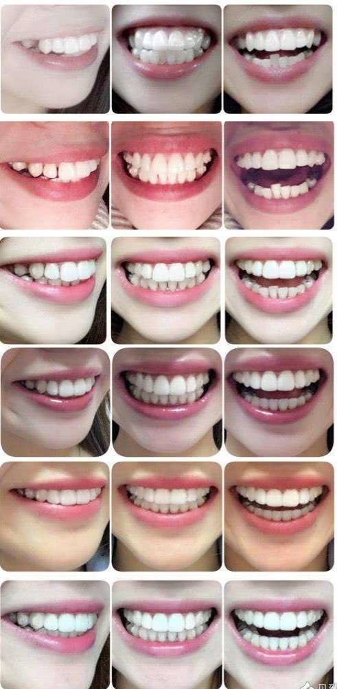 荆州牙科医院哪家技术好？种植牙、牙齿矫正这几家实力机构值得推荐！(图3)