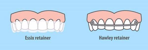 贵阳牙齿矫正价格一览表:德韩口腔、君雅京恬等医院矫正费用解析(图2)