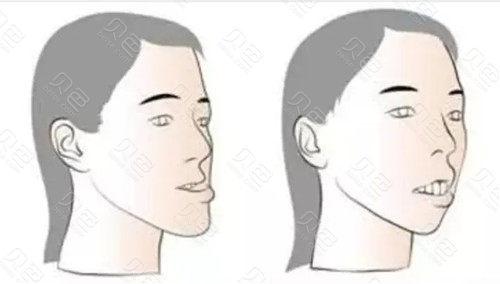 沈阳牙科医院哪家好?2025年最新牙齿矫正与口腔整形医院排名揭晓!(图1)