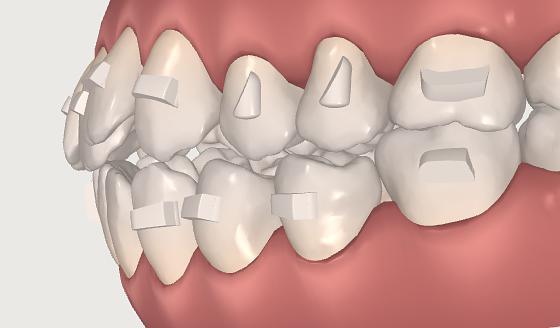 连云港江南口腔看牙靠谱吗?解析医生团队实力与种植牙技术优势!(图1)