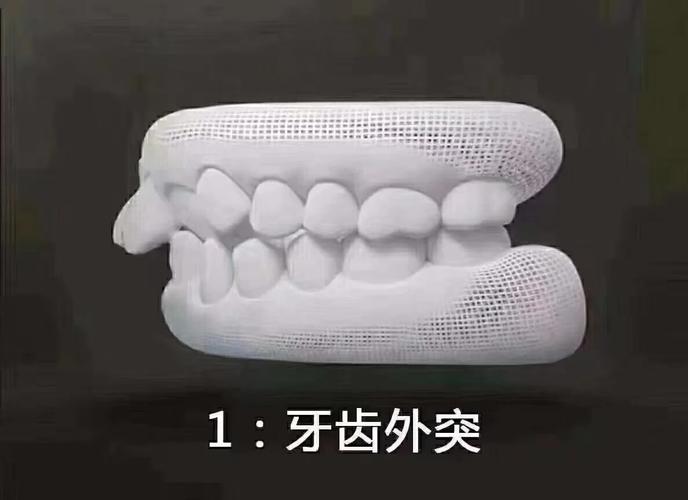 廊坊香河县牙齿矫正哪家好？2025年最新正畸医院排名与收费解析