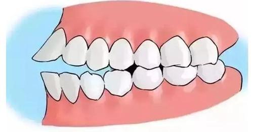 贵阳戴牙套好的医院有哪些？精选3家本地口碑好的正规口腔医院，专业可靠！(图1)