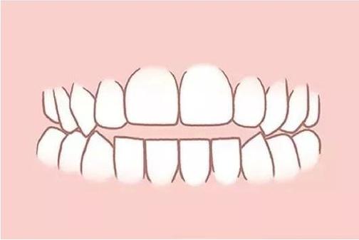 淮南济舟口腔2025年最新收费价格表公布,洗牙99元起+进口种植牙4980元+隐形矫正26800元起!(图1)