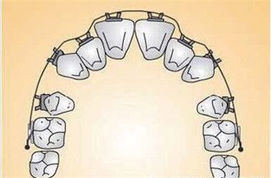 盘点东莞热门牙科机构，这三家口腔正畸技术领先需提前预约(图1)
