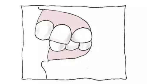 台州麦尔口腔2025年收费标准公布:种植牙-牙齿矫正-补牙-拔牙-牙周治疗价格明细一览(图1)