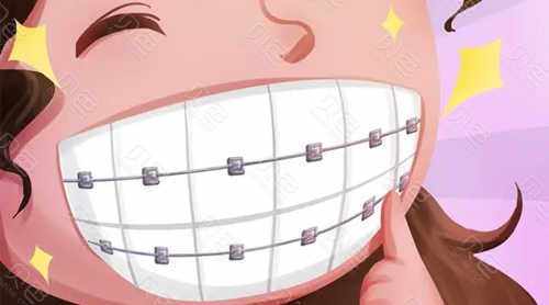 2025上海牙齿矫正医院口碑排行:排名靠前的医院是上海华韵口腔门诊部、上海雅悦齿科·雅杰口腔