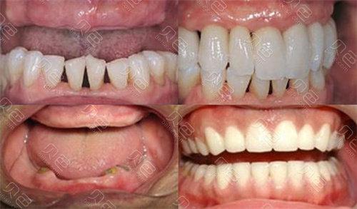 全方位解析漳州东南口腔怎么样！简介-医生团队-技术优势全曝光！