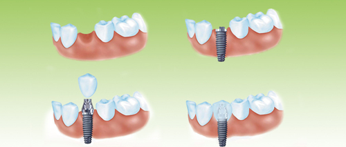 赣州哪家口腔医院技术好收费合理？丽齿健-罗焕锋-贝壳口腔专业测评(图1)