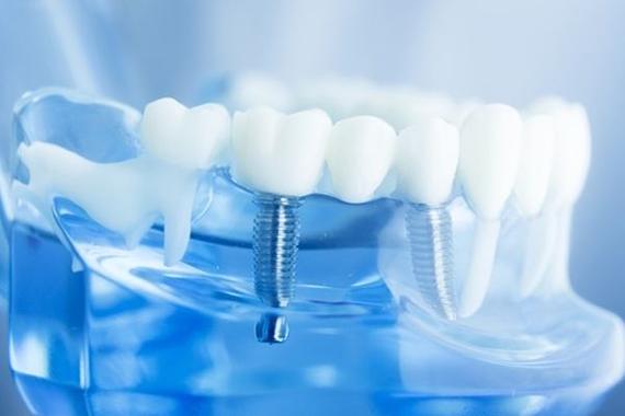 常州天宁雅意口腔医院正规靠谱吗？医生团队+设备+口碑全方位解析！