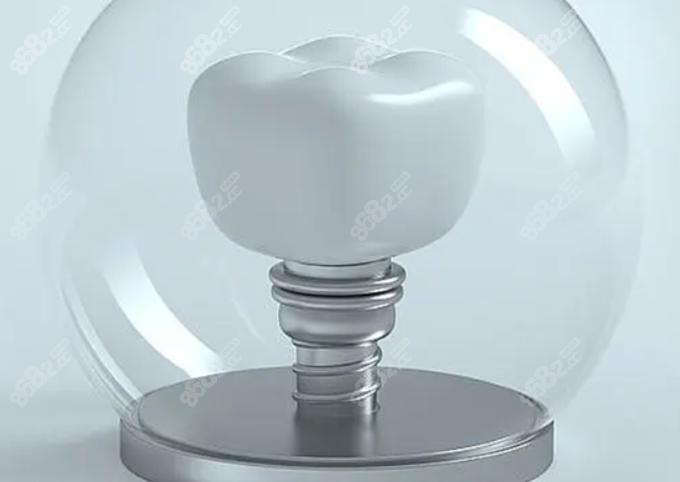 牙齿种植后为什么需要定期维护?种植牙能用多久?漳州东南口腔专家详解(图3)