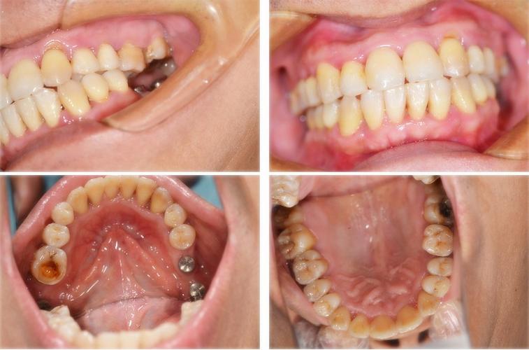 绵阳看牙好口腔排名分享,绵阳恒齿-皓铭-唐友生-卓益佳-臻品口腔实力出众!(图3)